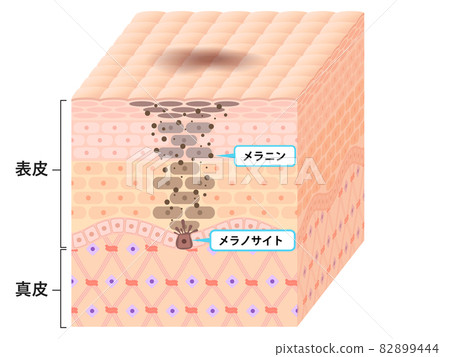 Skin cross section (blot) 82899444