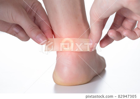 A woman sticks a medical plaster for the treatment of warts on the foot. Close-up A woman sticks a medical plaster for the treatment of warts on the foot. Close-up 82947305