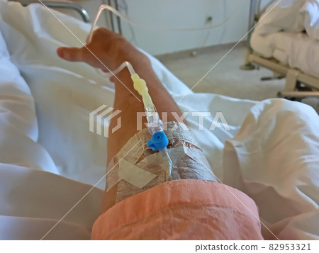 Peripheral venous catheter in the vein of human hand. 82953321