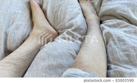 女性的小腿和腿部有很多多餘的毛髮 83003590