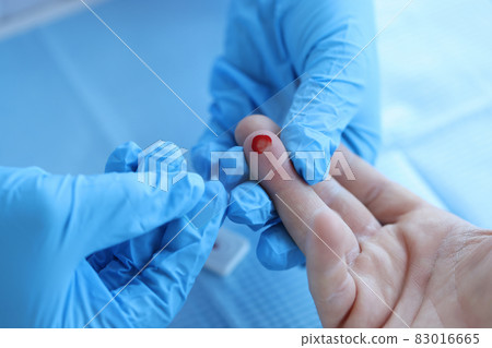 Doctor takes blood sample to check hemoglobin level closeup Doctor takes blood sample to check hemoglobin level closeup 83016665