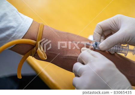 Arm of a man collecting blood 83065435