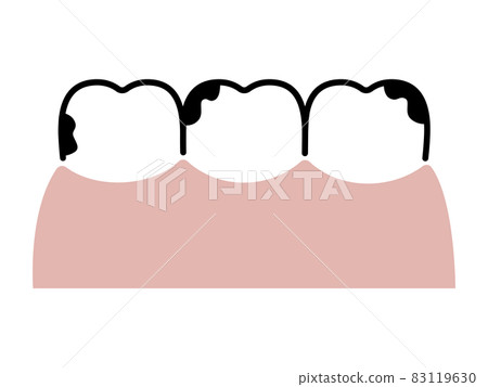 齲齒/臟牙（一字排開）/簡單畫線 83119630