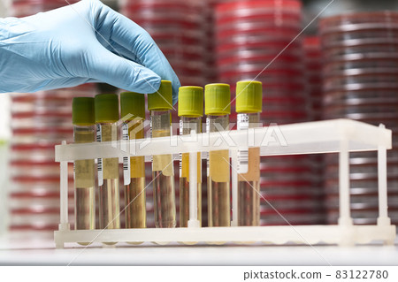 Test-tubes with yellow liquid in the laboratory Test-tubes with yellow liquid in the laboratory 83122780
