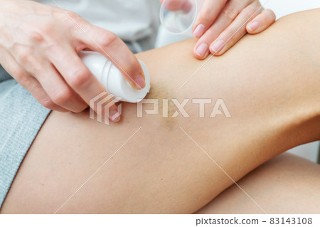 The woman has bruises on her legs, the girl spreads cream on the bruise. Domestic violence concept. The woman has bruises on her legs, the girl spreads cream on the bruise. Domestic violence concept. 83143108