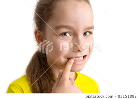 Little girl stands on a white background with a beautiful smile, children crooked teeth, pediatric dentistry. Crooked teeth close-up. Correction of malocclusion is required. 83151892