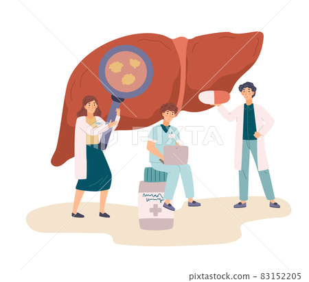 Liver hepatitis treatment concept in flat vector illustration isolated on white 83152205