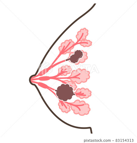 乳腺癌圖 83154313