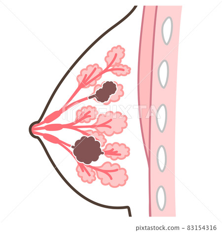乳腺癌圖 83154316