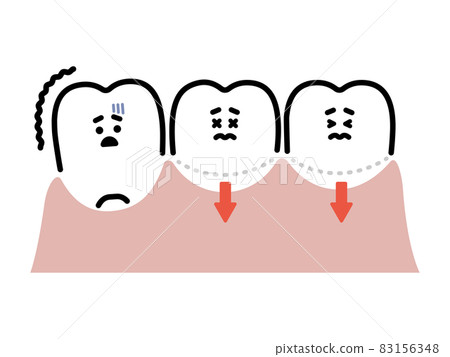 牙齦下降 / 牙齒可能脫落 特徵 83156348