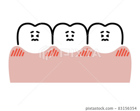 紅腫的牙齦和牙齒特徵 83156354