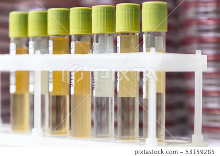 Test-tubes with yellow liquid in the laboratory 83159285