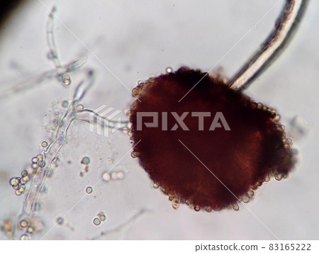 黑色黴菌孢子 83165222