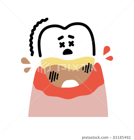 Severe periodontal disease tooth (1) character 83185492