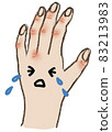 Rough hand 83213983