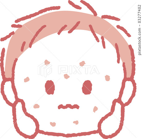 Illustration of a boy with a rash Illustration of a boy with a rash 83277482
