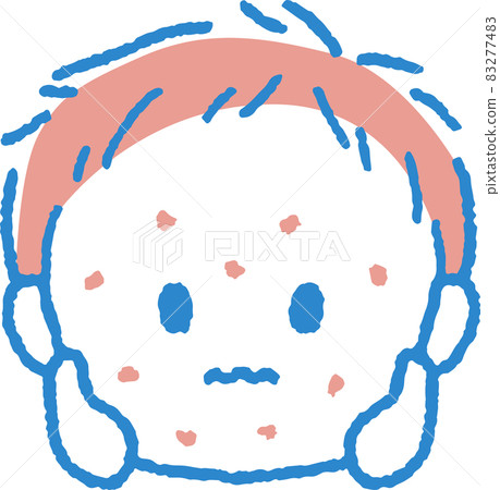 Illustration of a boy with a rash 83277483