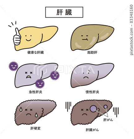 簡單說明 肝 脂肪肝 慢性肝炎 急性肝炎 肝硬化 肝癌 83348160