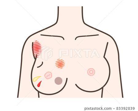 Signs of chest illness Signs of chest illness 83392839