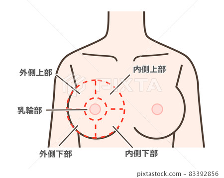 Illustrations explaining the most common areas such as breast cancer Illustrations explaining the most common areas such as breast cancer 83392856