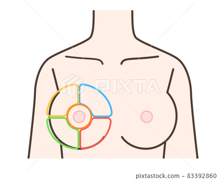 乳腺疾病分類說明 乳腺疾病分類說明 83392860