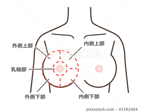 Breast disease classification illustration 83392864
