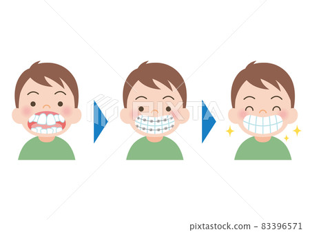 A boy who corrects teeth 83396571