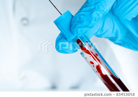 Doctor in blue gloves keep in hands test tube with a blood and syringe Doctor in blue gloves keep in hands test tube with a blood and syringe 83453058