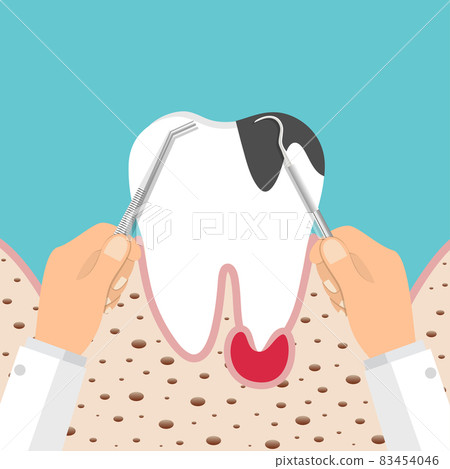 Dentist holding instruments and examining patient teeth. Teeth examination dentistry concept. Dentist holding instruments and examining patient teeth. Teeth examination dentistry concept. 83454046