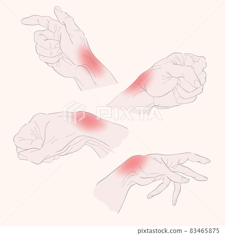 Wrist pain from office syndrome, hand pain Wrist pain from office syndrome, hand pain 83465875