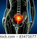 3d rendered illustration of the female sacrum bone - front view 83473677