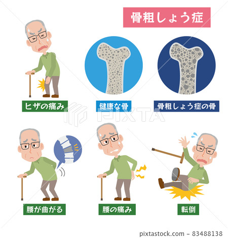Image of osteoporosis and older men Image of osteoporosis and older men 83488138