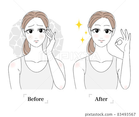 Women's beautiful skin, skin troubles, beauty skin care, dry skin, cracks, worried faces, troubled faces, tank tops, before and after Women's beautiful skin, skin troubles, beauty skin care, dry skin, cracks, worried faces, troubled faces, tank tops, before and after 83493567