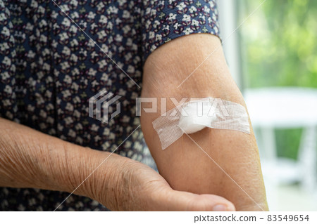 Asian senior or elderly old lady woman patient show cotton wool stop bleeding, after blood drawing testing for annually physical health check up to check cholesterol, blood pressure, and sugar level. Asian senior or elderly old lady woman patient show cotton wool stop bleeding, after blood drawing testing for annually physical health check up to check cholesterol, blood pressure, and sugar level. 83549654