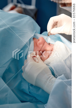 Close up of the face of a patient who is undergoing blepharoplasty. The surgeon cuts the eyelid and performs manipulations using medical instruments 83576668