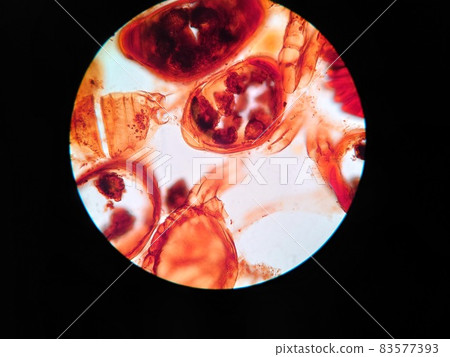 Spore of Cryptomeria japonica 83577393