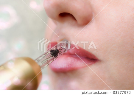 Lip augmentation treatment hyaluron pen device 83577973