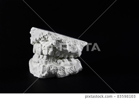 Teeth cast mold of the jaw made of plaster for orthodonist work Teeth cast mold of the jaw made of plaster for orthodonist work 83598103