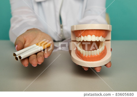 Plastic model of the jaw and cigarette in the hands of a dentist. Smoking addiction 83605680