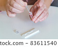 The woman takes a blood sample with a pipette from his finger 83611540