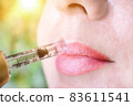 Lip augmentation treatment hyaluron pen device 83611541
