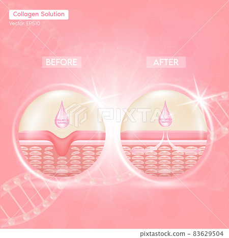 Process of getting skin younger with help of Collagen Solution before and after skin solutions ad, 83629504