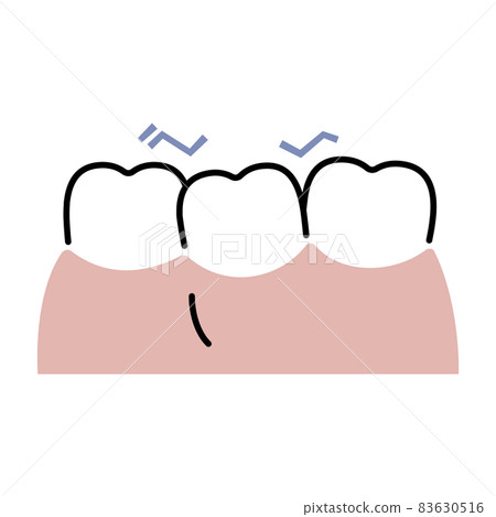 Teeth with poor alignment 83630516