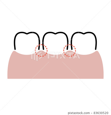 Successful teeth 83630520