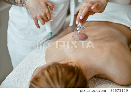 professional female specialist is doing cupping therapy on the back of beautiful caucasian lady professional female specialist is doing cupping therapy on the back of beautiful caucasian lady 83675129