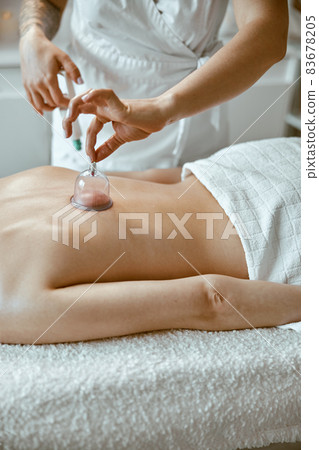 professional female specialist is doing cupping therapy on the back of beautiful caucasian lady professional female specialist is doing cupping therapy on the back of beautiful caucasian lady 83678205