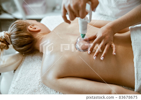 professional female specialist is doing cupping therapy on the back of beautiful caucasian lady professional female specialist is doing cupping therapy on the back of beautiful caucasian lady 83678675