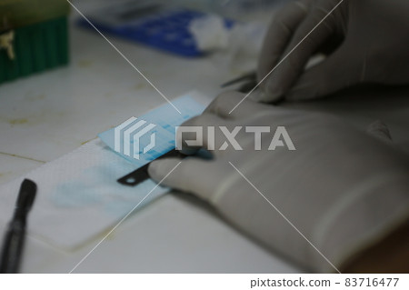 蛋白質轉印 蛋白質轉印 83716477