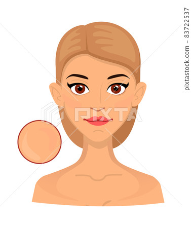 Woman different types of normal skin, enlarged area for cosmetology. Acne, wrinkles and age spots. Woman different types of normal skin, enlarged area for cosmetology. Acne, wrinkles and age spots. 83722537
