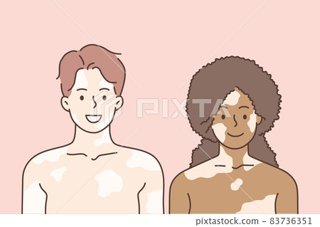 Vitiligo and mixed race love concept Vitiligo and mixed race love concept 83736351